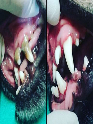 Profilaxis Dental